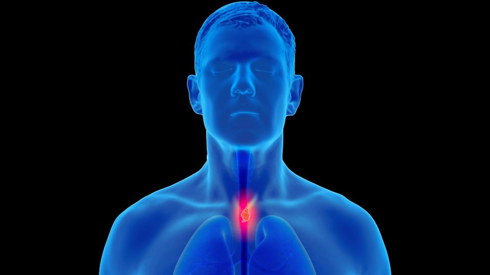 食道粘膜下腫瘍